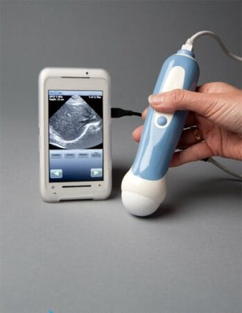MobiUS SP1 1 MobiUS SP1 1