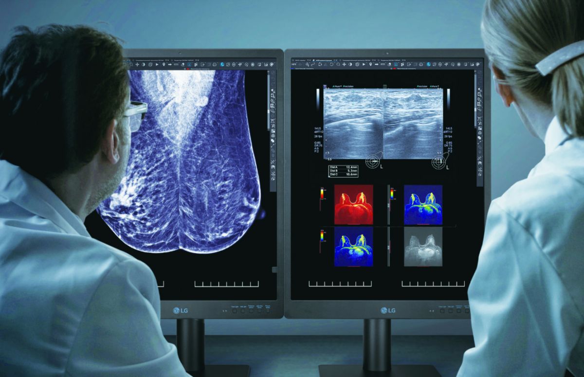LG 21HQ613D: Monitor 2K dengan Tingkat Kecerahan 1100-nit untuk Segmen Medis 40 LG 21HQ613D