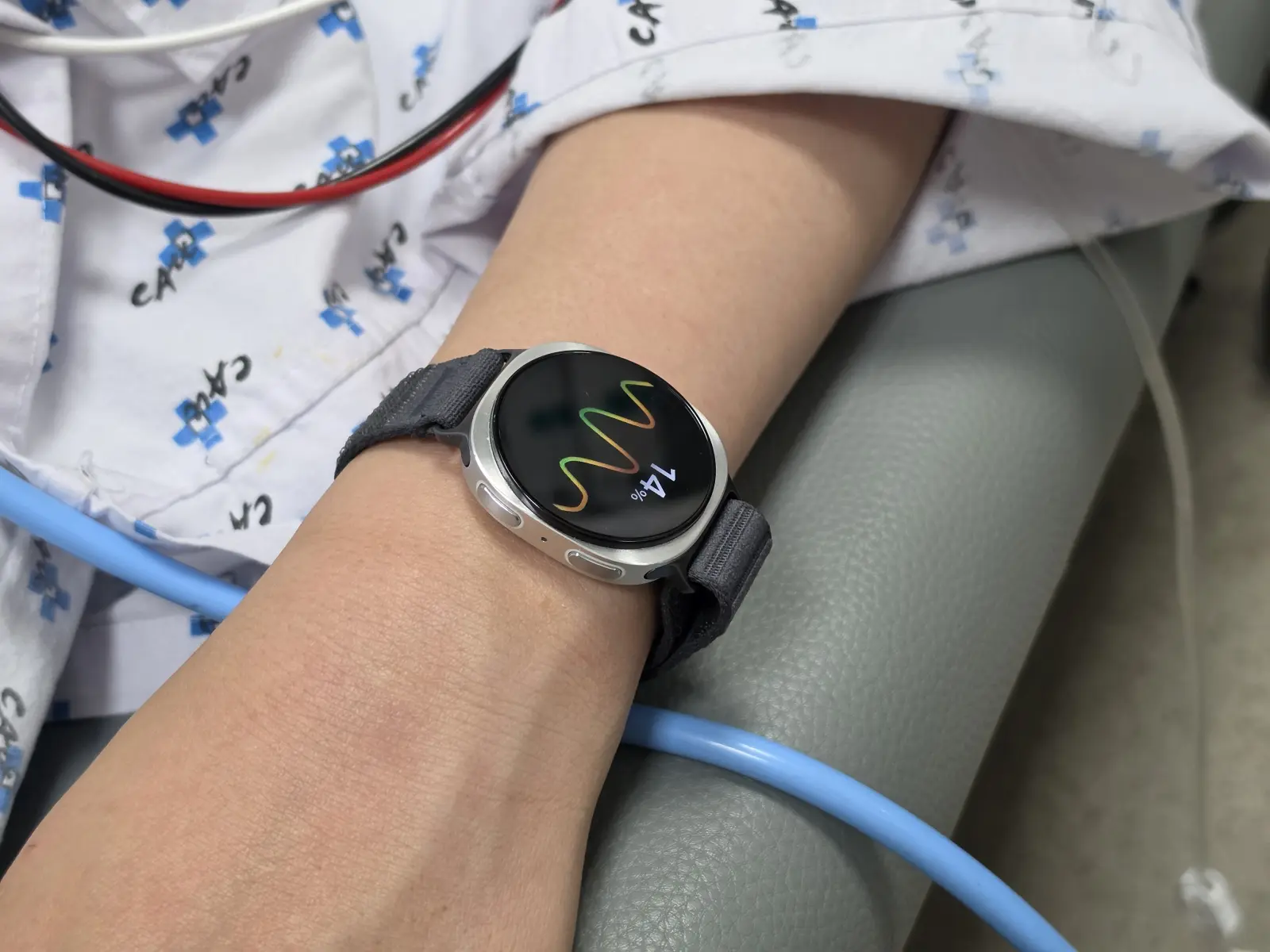 Samsung Umumkan Terobosan Pertama di Dunia untuk Memprediksi Pingsan dengan Galaxy Watch